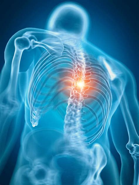 Spinal Cord Compression Symptoms: What Does It 